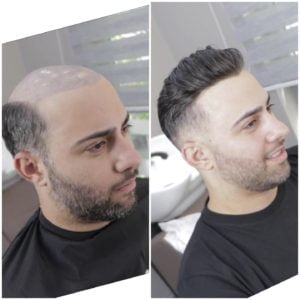 Hair clipping services in Hyderabad